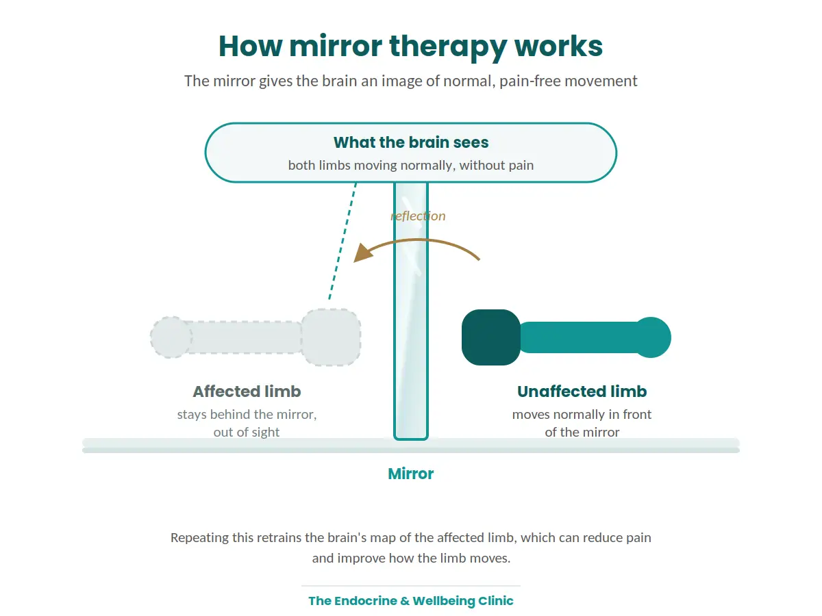 Exercise Physiology diagram-mirror-therapy